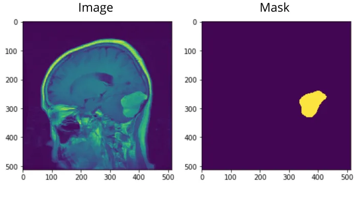 How To Evaluate Image Segmentation Models