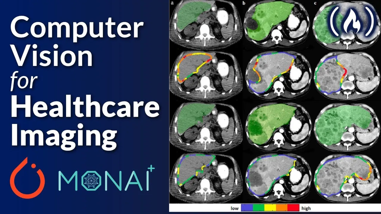 AI Healthcare Imaging with Python, PyTorch and Monai