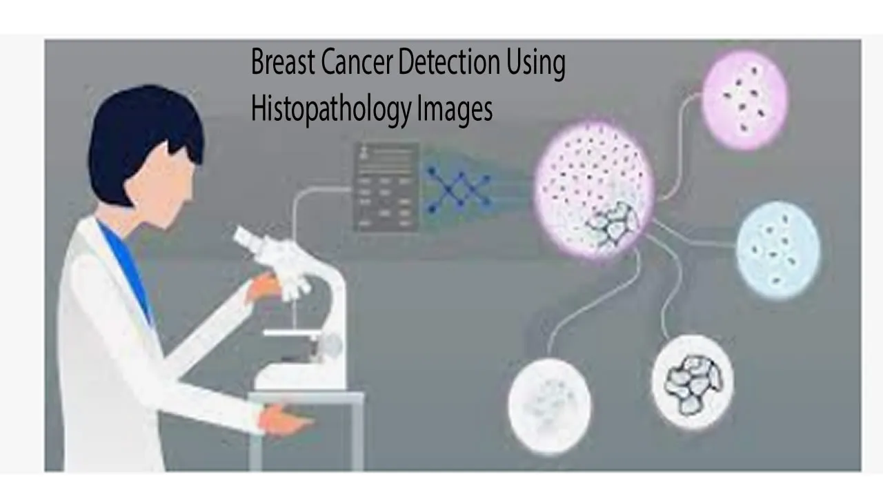 Breast Cancer Detection Using Histopathology Images 