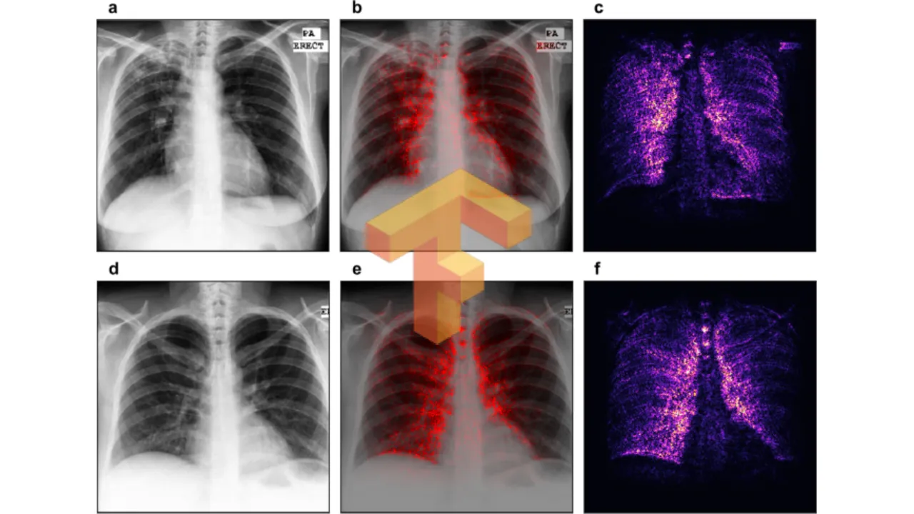 X-ray Image Classification and Model Evaluation