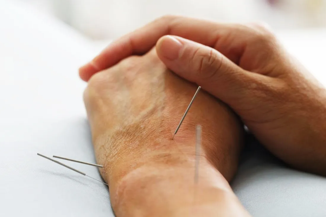 Can Acupuncture Treat Vertigo